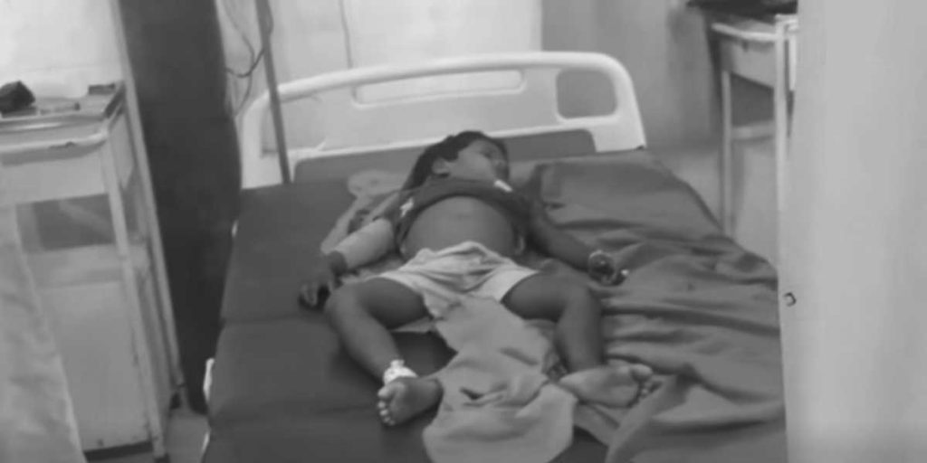 सर्लाहीमा सर्पदंशबाट तीन वर्षीय बालकको मृत्यु, चिकित्सकमाथि लापर्बाहीको आरोप